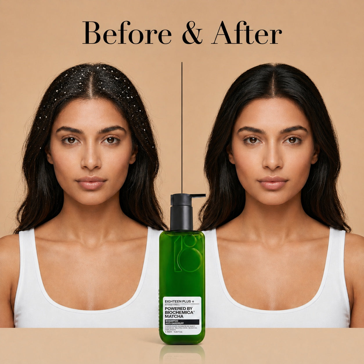 18+ Anti Dandruff Shampoo 250ml