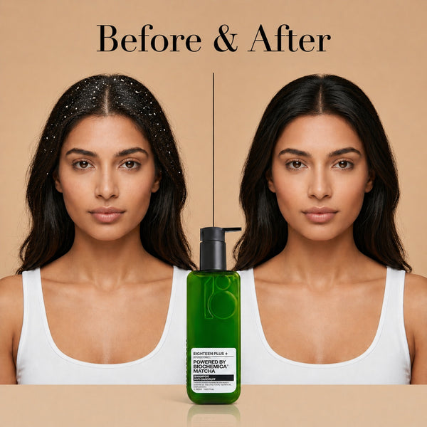 Flake-free Scalp & Balanced Hydration
